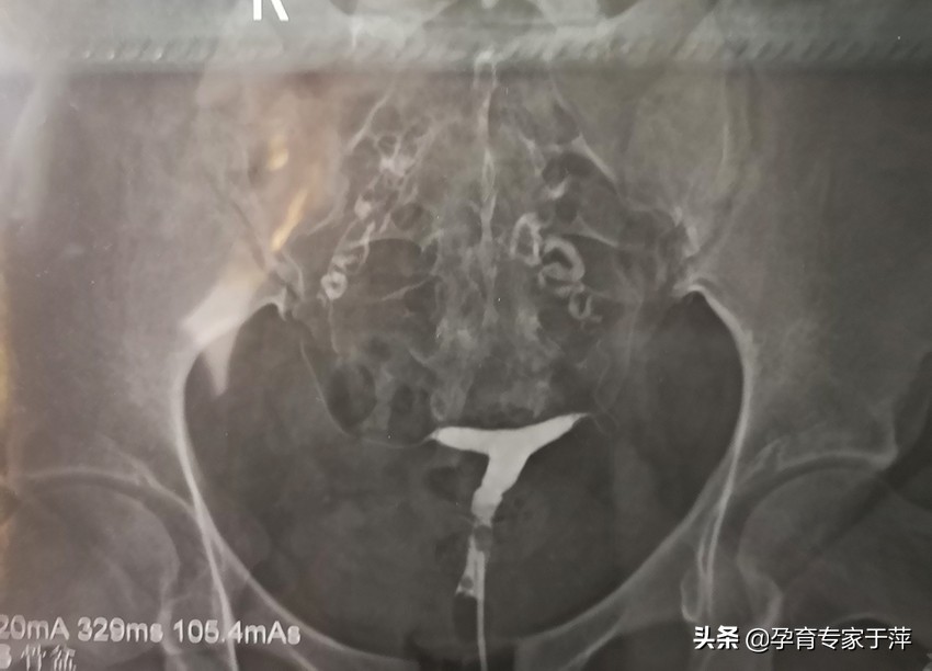 于萍主任青岛,青岛妇儿输卵管造影怎么样