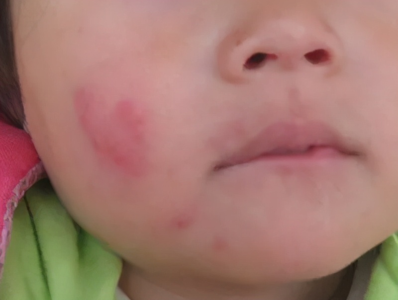 妈妈给孩子涂护肤霜,妈妈给小孩子抹药