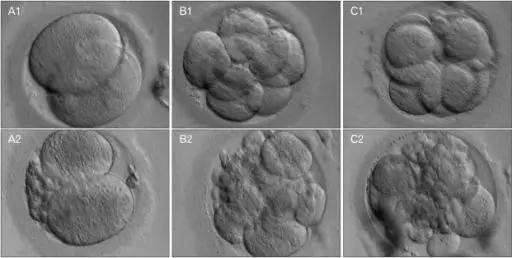 试管解密——精子卵子如何在医生巧手下受精？