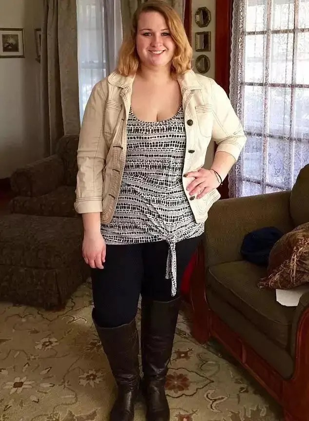 缩胃减肥前后对比,360斤缩胃手术一年减肥成功案例