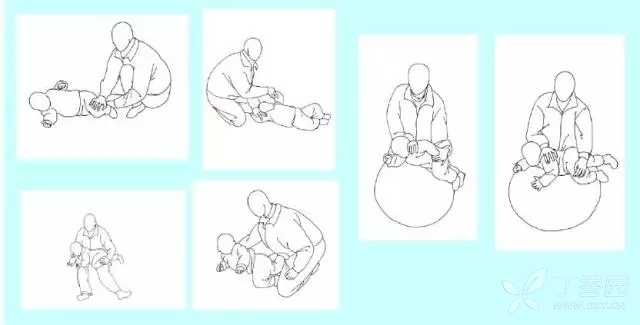 脑瘫儿童运动疗法操作规范,脑瘫儿核心力量差怎么练