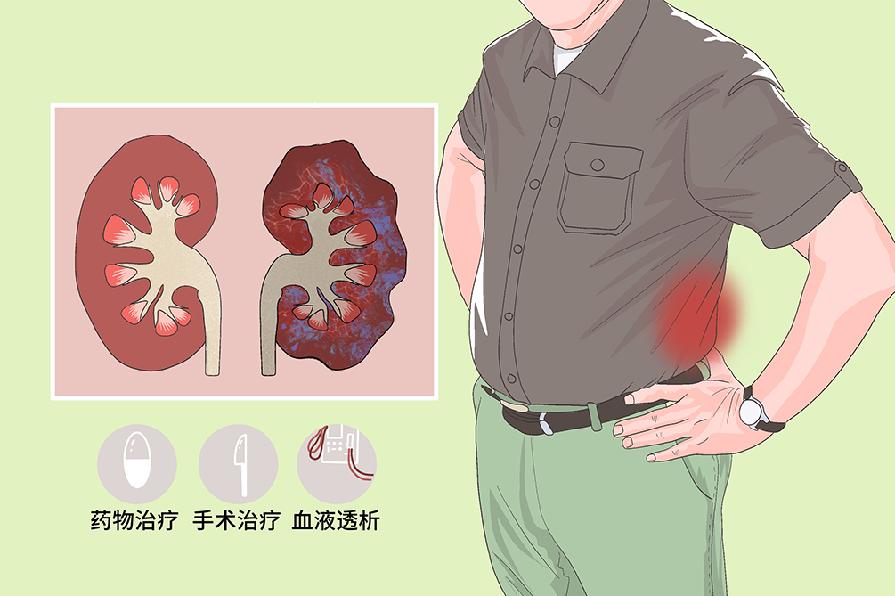 心血管疾病一定同型半胱氨酸高吗,吃半胱氨酸会引起心血管疾病吗