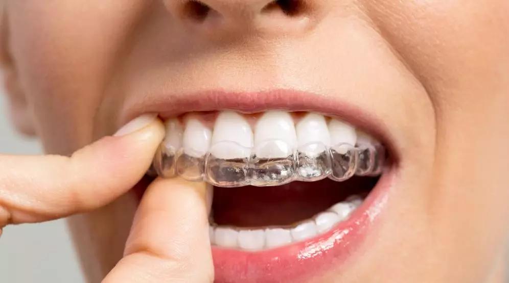 牙齿矫正隐形和普通的有什么区别,隐形牙齿矫正好第一步应该干什么