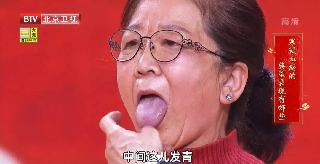 血瘀也分寒热,切勿盲目化瘀!三杯代茶饮,凉血化瘀,血管畅通