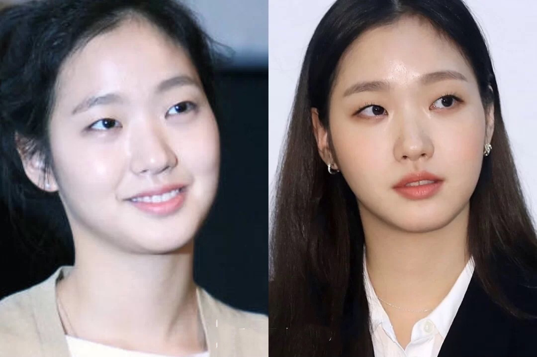 单眼皮肿眼泡韩系眼妆,单眼皮肿眼泡消肿眼影