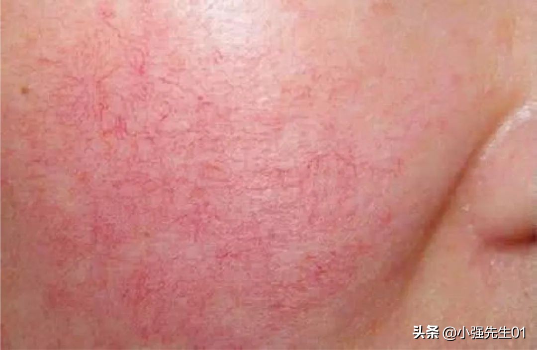 看完这些廉价面膜你还敢买吗,便宜又烂脸的面膜有哪些