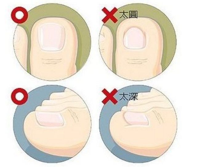 给宝宝修剪指甲正确的方法,用指甲剪给宝宝修指甲的危害