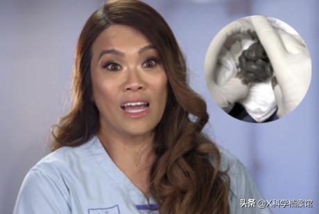 疯了!挤黑头视频7000万人看,为什么网友一边直呼恶心一边追着看