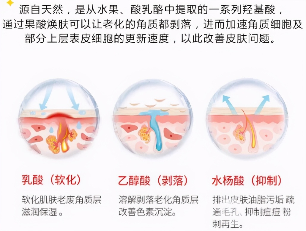 医美祛痘治疗有几种？怎么选择？超全科普告别痘肌