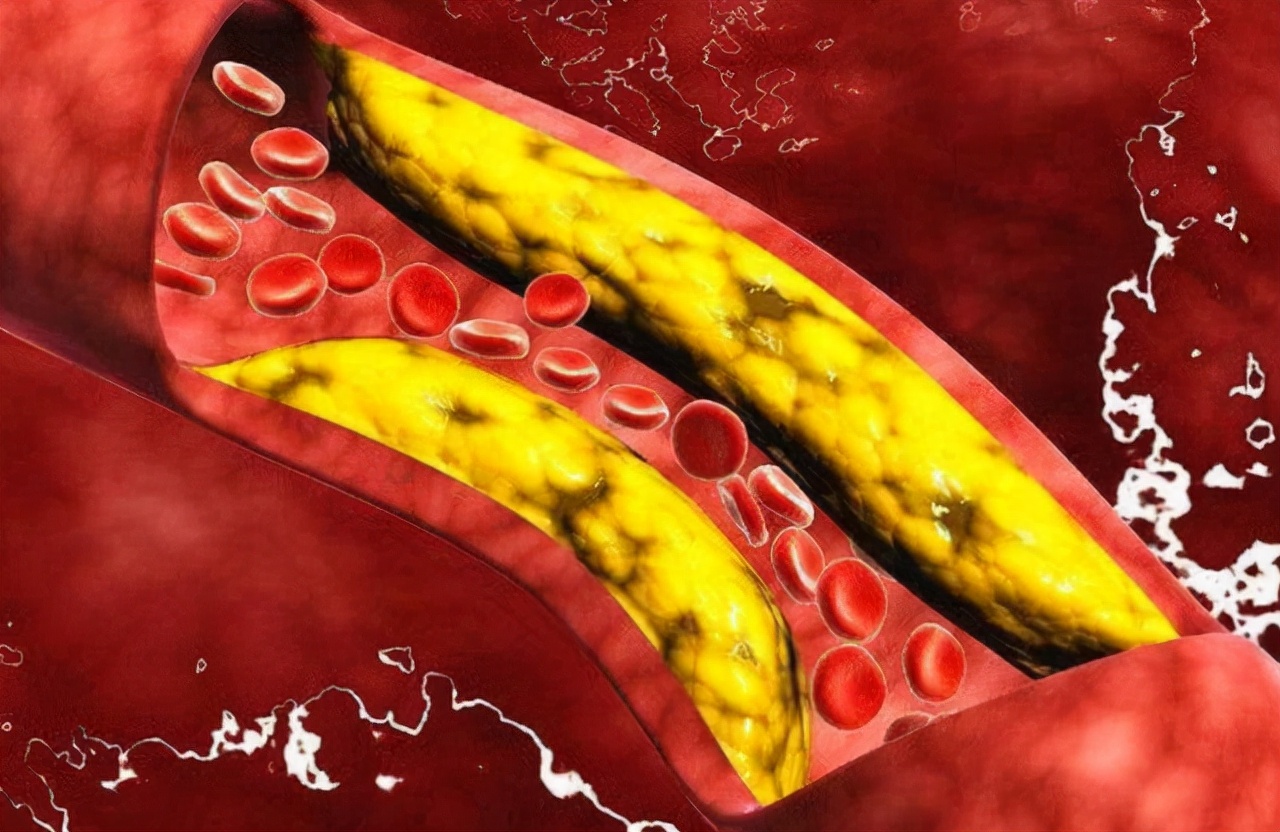 坚持不穿“内衣”,身体会有哪些变化?听听这位湖南宝妈怎么说