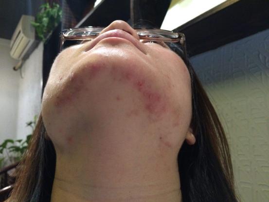 护肤烟酰胺安全产品有哪些,护肤烟酰胺的作用与功效