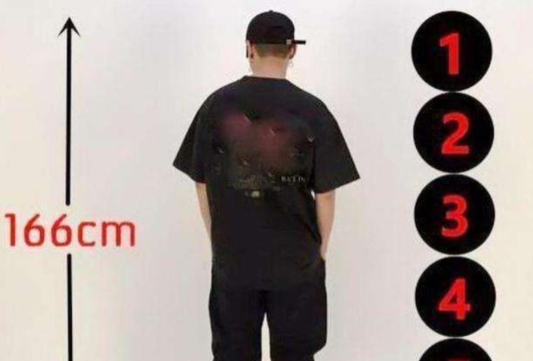 断骨长高李亚诺现状,中国断骨增高第一人李亚诺