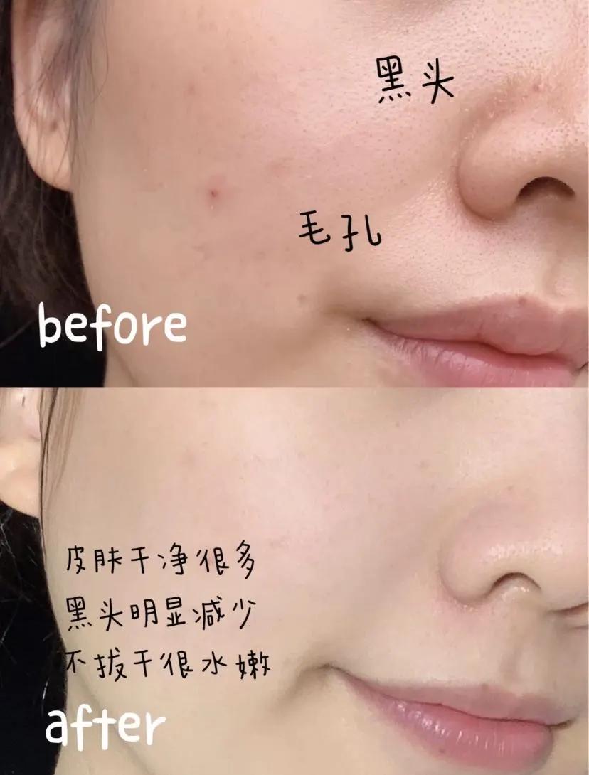 媲美“刘诗诗的百万修图师”，有了这款面膜，你也能拥有好皮肤