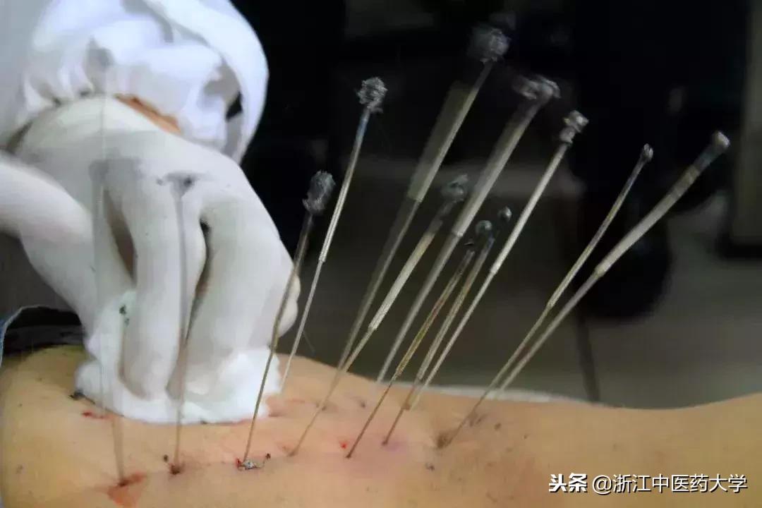 用镜头诉说中医药之美