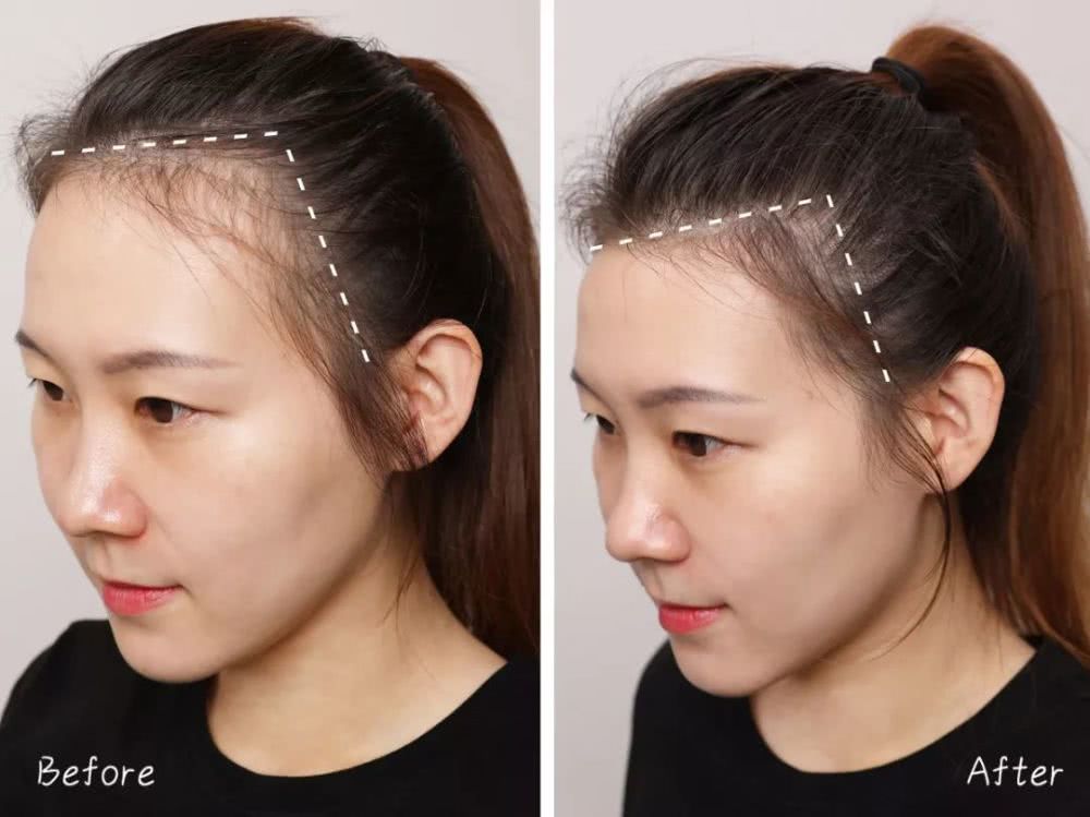 头发少一根，颜值减5分！“秃头女孩”必知“拯救发型”技巧