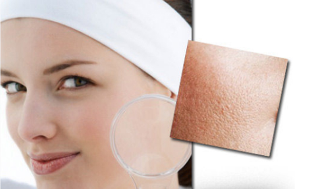 试试这3招很有效的去黑头小妙招,一招教你消灭黑头