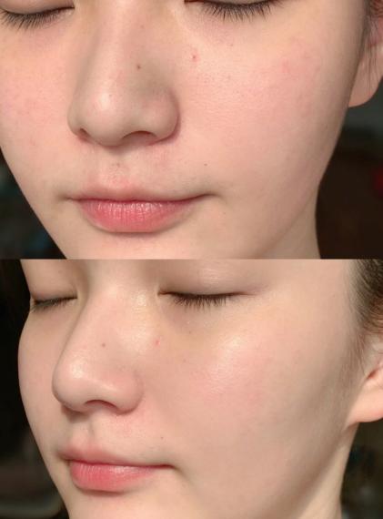 想拥有赵丽颖同款肌肤?这款澳洲绵羊油,冬天也能焕发“新肌”