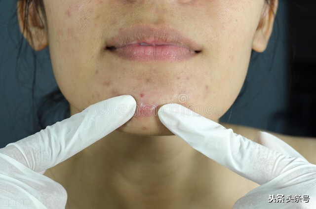 随着年龄增长人脸皮肤会变粗糙,人脸皮肤组织示意图