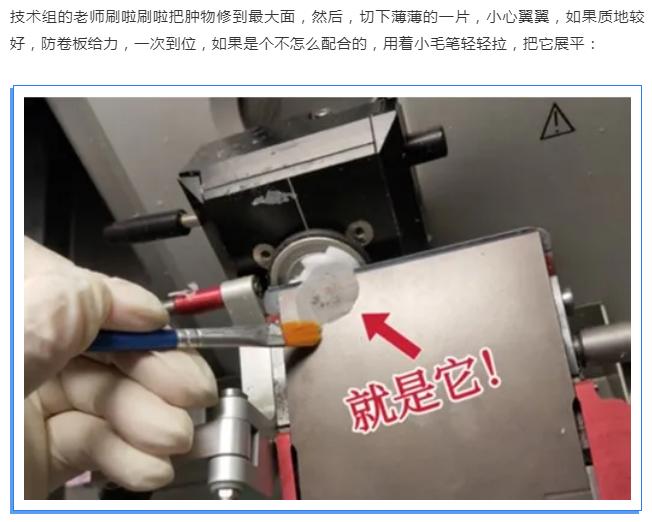 肿瘤防治科普视频,肿瘤冷冻切片和病理哪一个准确