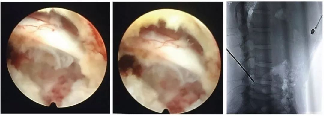 临淄区人民医院骨二科,中心医院骨二科简介
