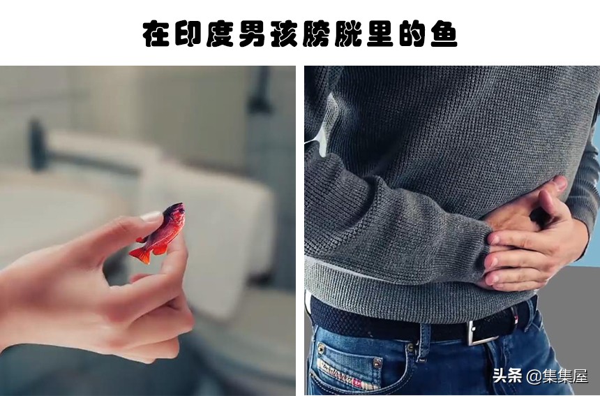 在人体内发现的6个难以用常理解释的物体