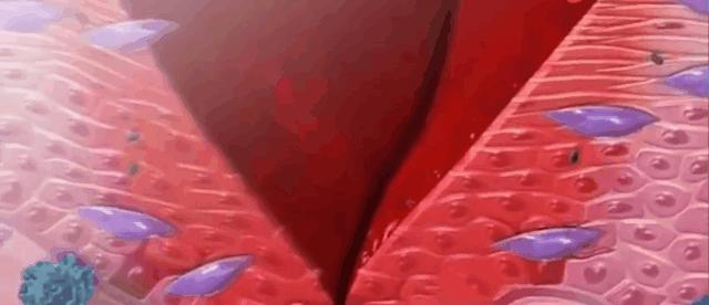 疤痕怎么自愈,疤痕是怎样治疗的呢