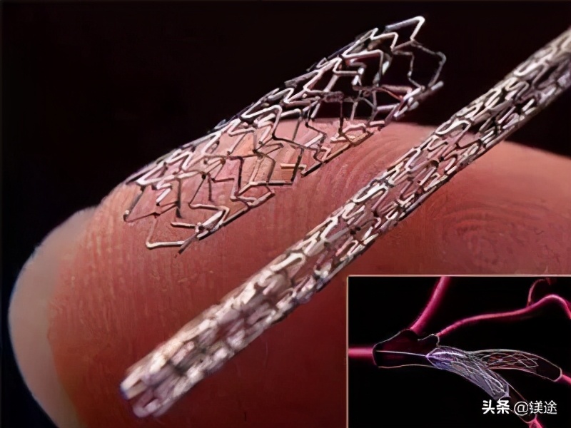 金属镁产业发展,镁金属发展前景