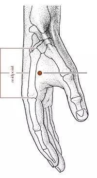 神经调控技术治疗抑郁症,针清知识普及