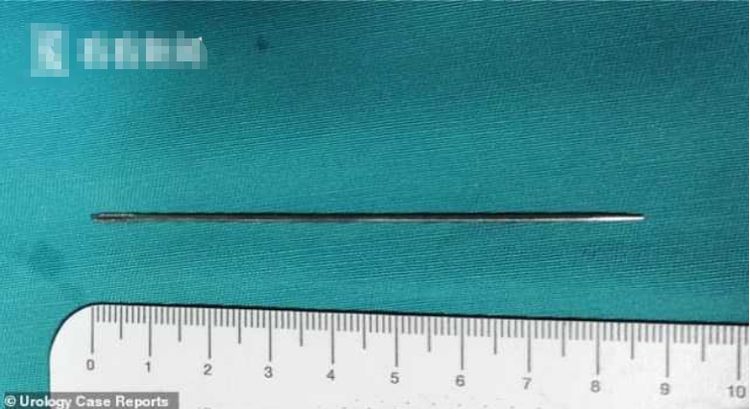 14岁男生把9厘米缝衣针插入尿道,痛苦三天去就医,网友:爽吗?