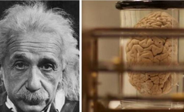 爱因斯坦临死前失去大脑,爱因斯坦死后大脑哪去了
