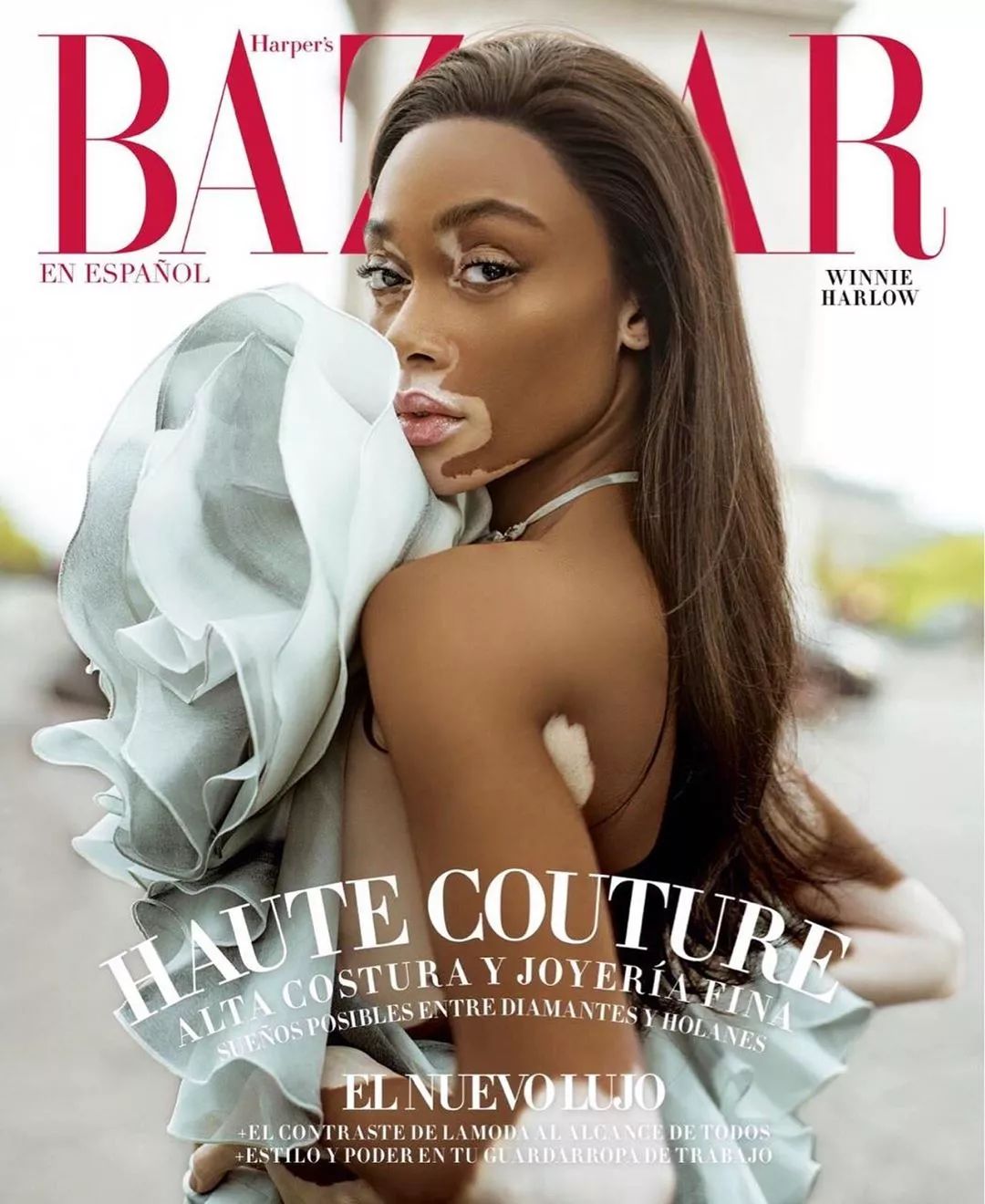 winnieharlow超模大赛,世界顶级超模winnieharlow