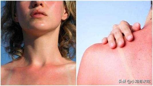 隔离和防晒真的很重要,防晒和隔离到底哪个重要