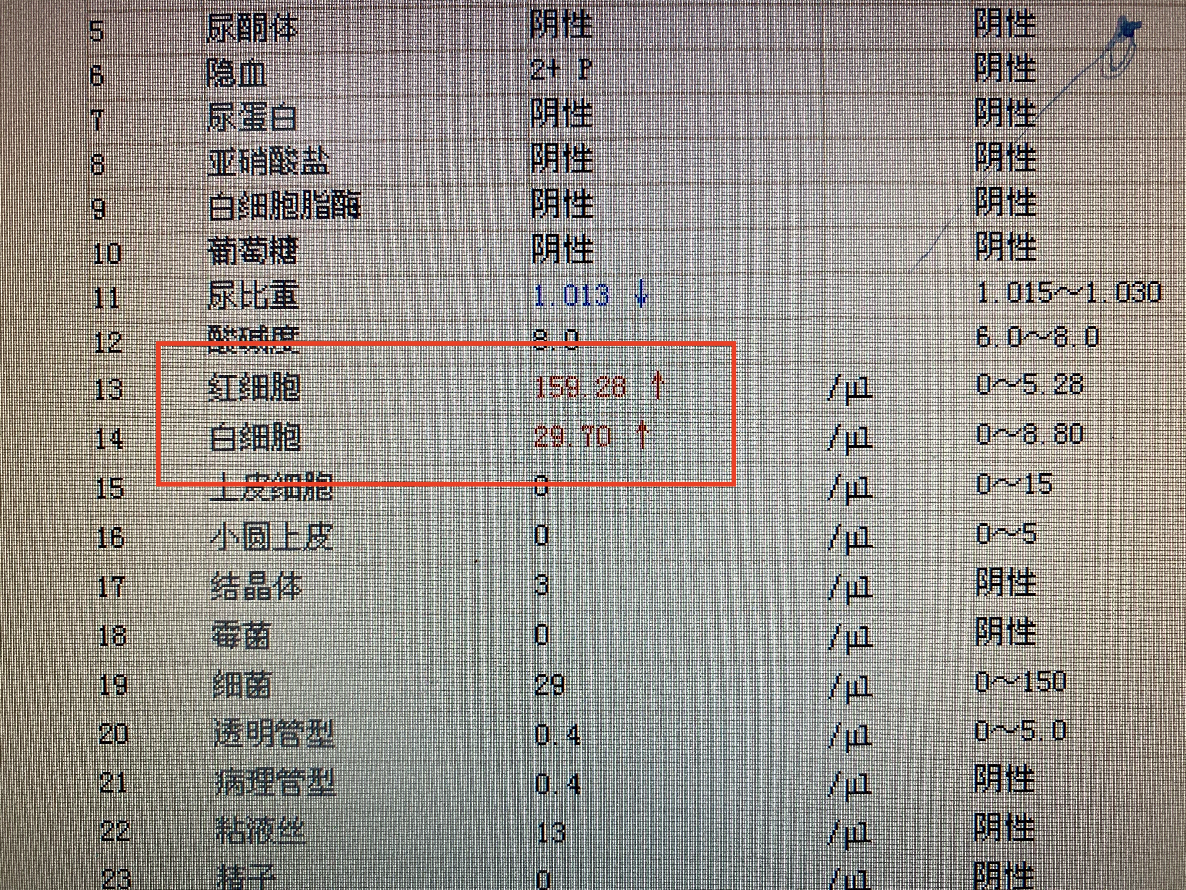 小便带血应该到什么科就医,男性小便带血如何治疗