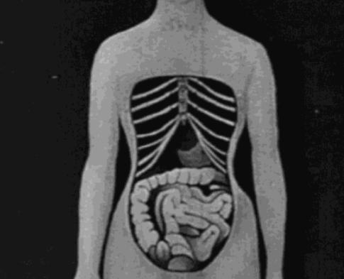 子宫下垂内脏下垂,网红束腰导致内脏下垂