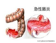 大半夜的肚子疼,一到半夜肚子疼