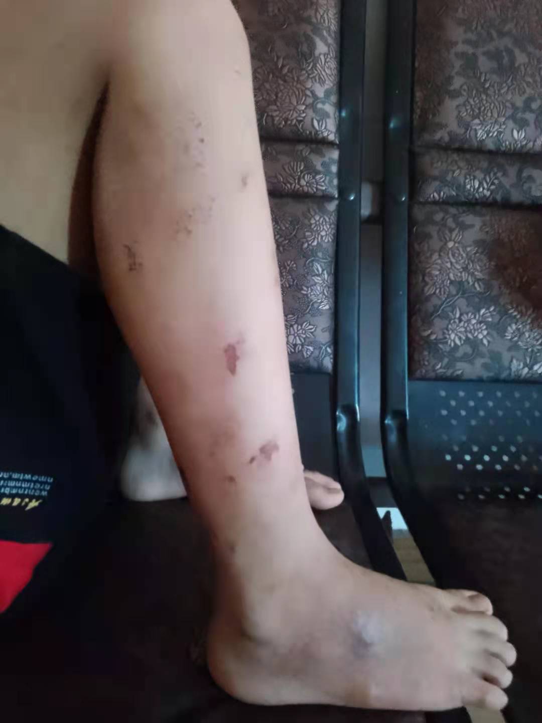 千万不要让小朋友吃太多辛辣和冰冻食品，有些食物相冲相克