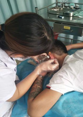 寻常疣是大问题还是小问题,寻常疣好处理吗