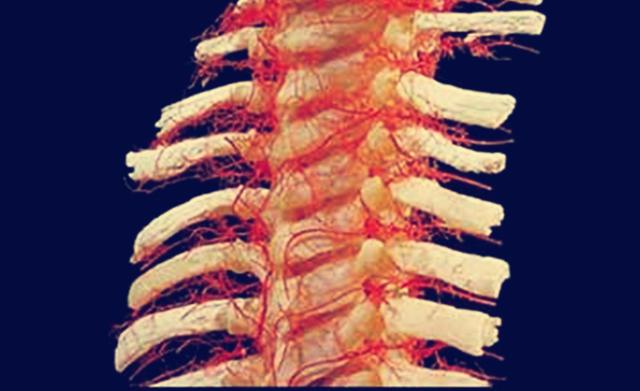 腰椎间盘突出什么方法好得快,腰椎间盘突出用什么方法好得最快