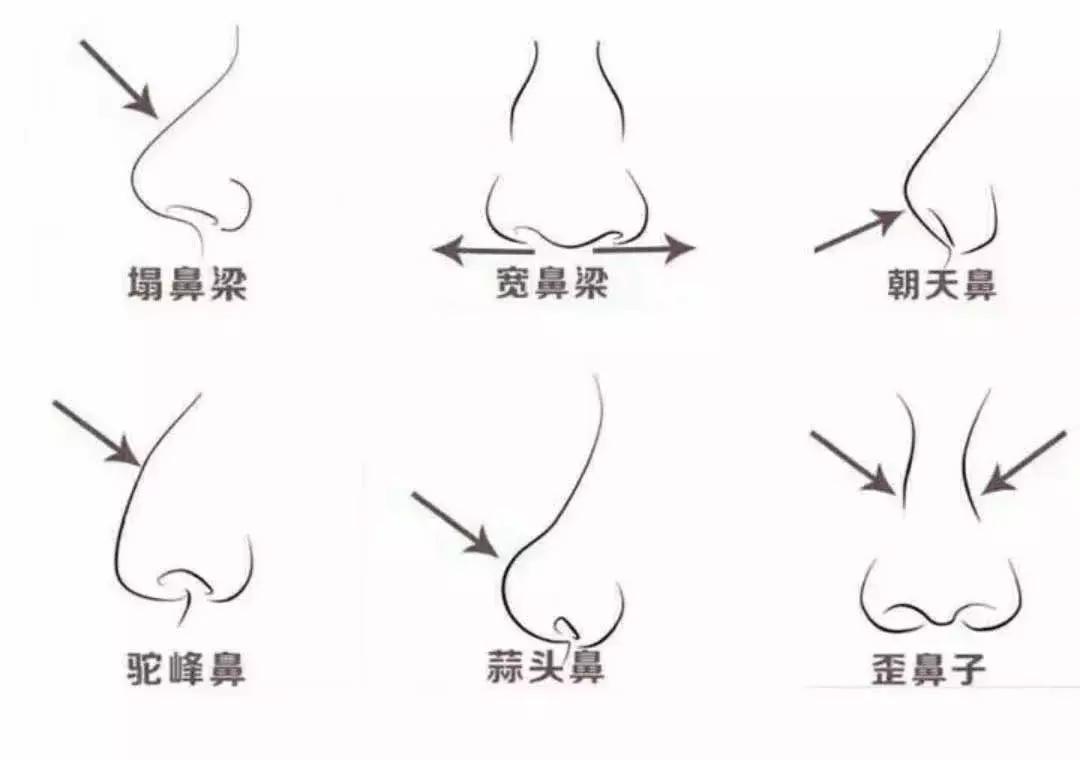 最好看的鼻子分哪几种,最好看的几种鼻子