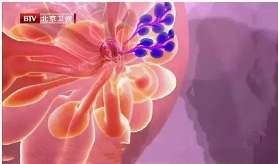 多吃4种食物可软化血管保护心脏,心血管病能吃豆腐吗