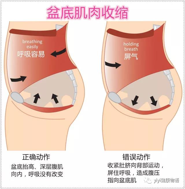 凯格尔盆底肌训练仪器,澜渟盆底肌凯格尔训练