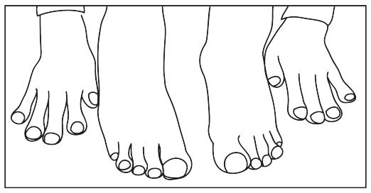 1.2公分的肺癌肿瘤是中期还是晚期,晚期肺癌肿瘤进展时间