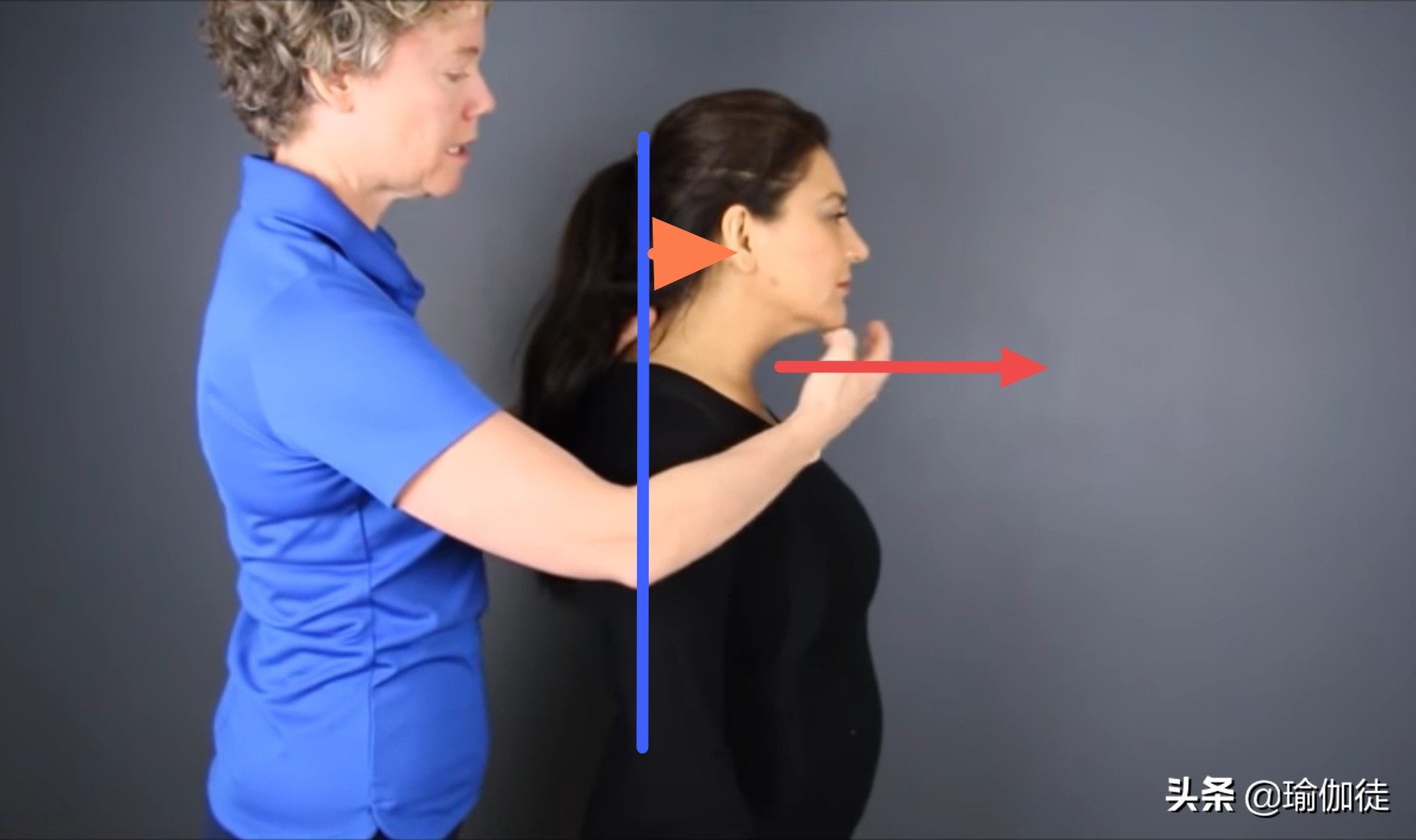 颈椎富贵包怎么消除最有效方法,怎样快速消除颈椎的富贵包