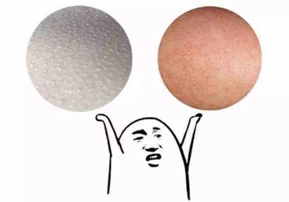 大腿内侧长了很多小点像是鸡皮肤,大腿上的皮肤像鸡皮