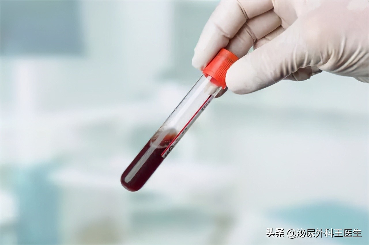 性病“梅毒”是如何横扫世界?