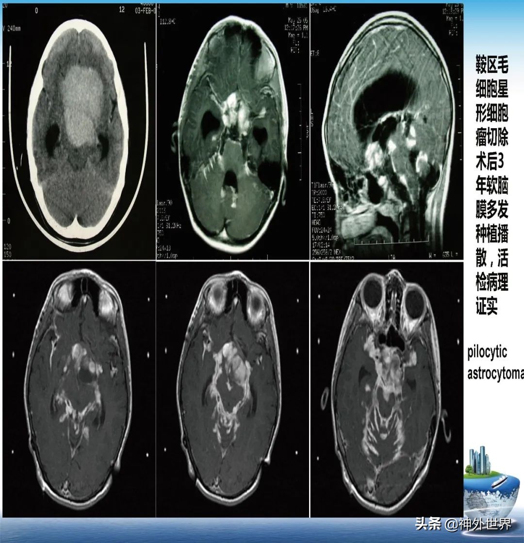 宣武医院神经外科王亚明祖籍,北京宣武医院神经科专家王亚明