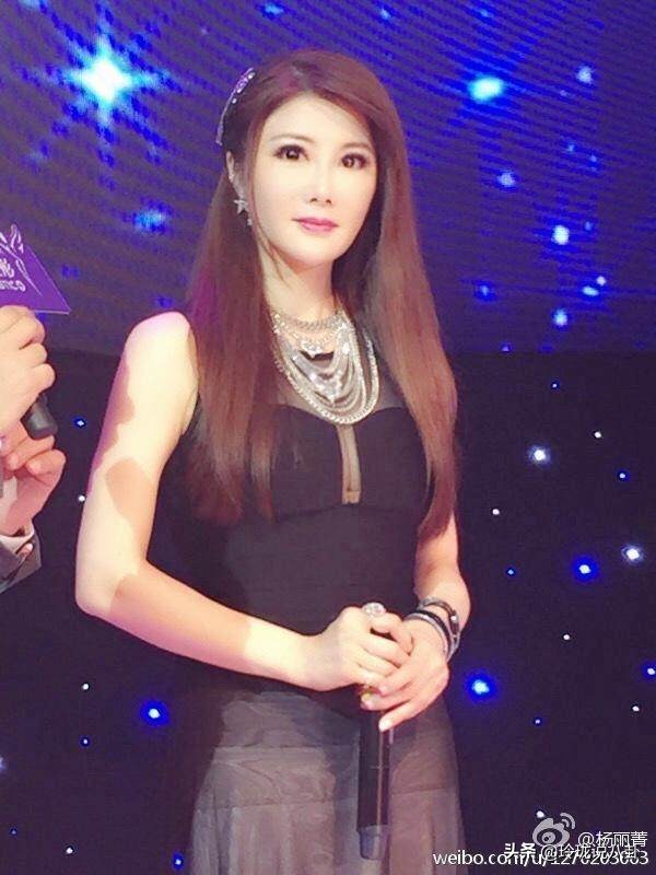 有哪些明星过度整容惨不忍睹,整容失败女明星今昔对比