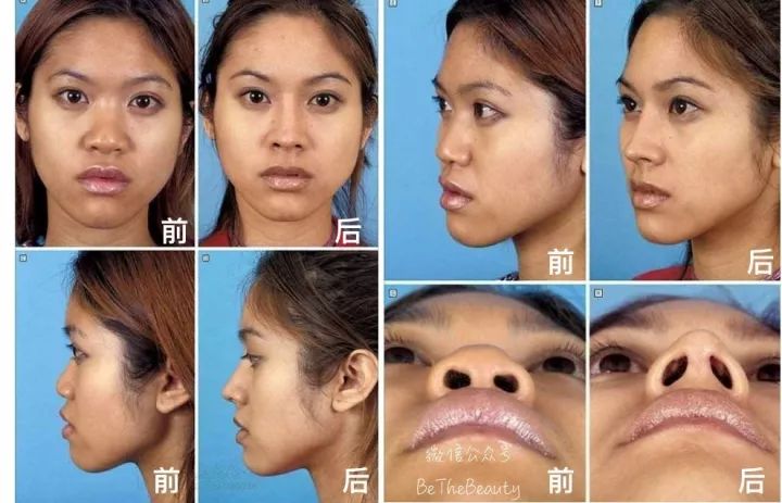 鼻梁很塌怎么画修容,塌鼻子大鼻头怎么画鼻影