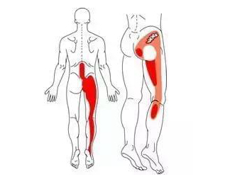 腰椎间盘突出躺在床上腿还疼,腰椎间盘突出了为什么腿会疼