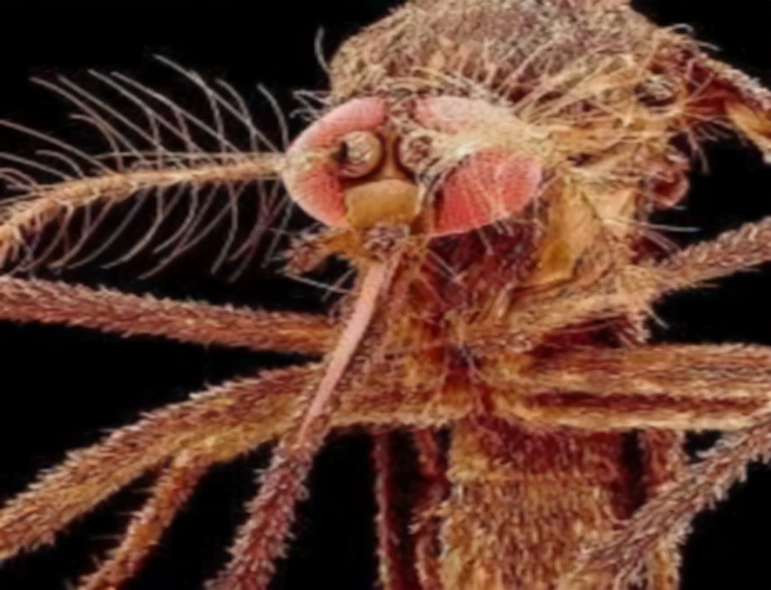 阴虱是什么？洁身自好的人为什么会得阴虱？一般有2个传播途径